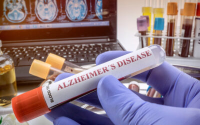 New Blood Test Can Predict Alzheimer’s Disease Early